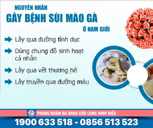 Điểm mặt: Nguyên nhân bị sùi mào gà ở nam giới