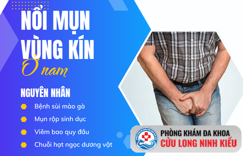 Nổi mụn ở nam – Dấu hiệu bạn cần đến gặp bác sĩ nam khoa ngay lập tức
