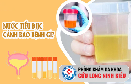 Nước tiểu đục ở nam là bị gì? Đừng chủ quan với dấu hiệu tưởng chừng vô hại