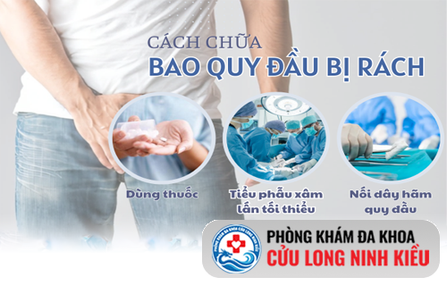 Giải pháp khắc phục rách dương vật an toàn, thẩm mỹ, không để lại sẹo