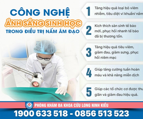 Chữa viêm nấm phụ khoa - cách điều trị hiệu quả