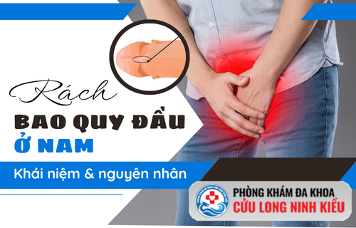 Rách bao quy đầu là gì? Tìm hiểu nguyên nhân với chuyên gia Nam Khoa