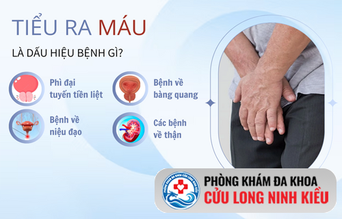 Tiểu ra máu bất thường ở nam và những nguyên nhân tiềm ẩn dễ bị bỏ qua