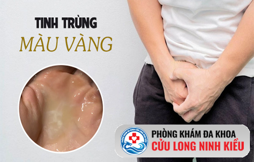 Tinh trùng vàng là gì?