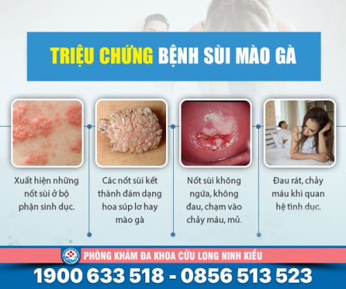 Nhận biết sớm triệu chứng của sùi mào gà kịp thời thăm khám