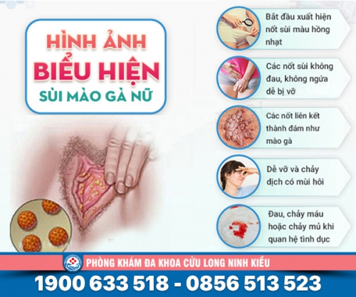 Biểu hiện bệnh sùi mào gà ở nữ giới - tìm hiểu chi tiết