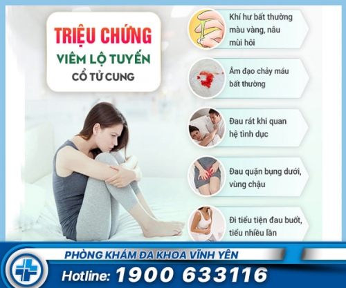 Những thông tin cần biết về viêm lộ tuyến cổ tử cung bẩm sinh