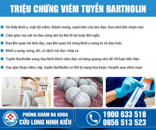 Mách bạn dấu hiệu viêm tuyến bartholin