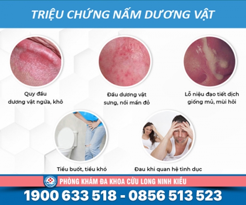 Nấm candida ở nam giới là như thế nào?