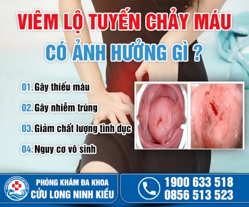 Viêm lộ tuyến chảy máu chị em đừng chủ quan!