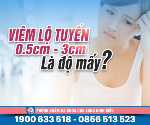 Viêm lộ tuyến 0.5cm - 3cm là độ mấy xem ngay