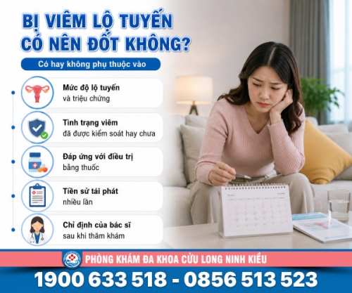 Bị viêm lộ tuyến có nên đốt không