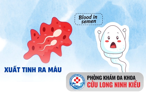 Xuất tinh ra máu – Khi cơ thể đang gửi tín hiệu cầu cứu